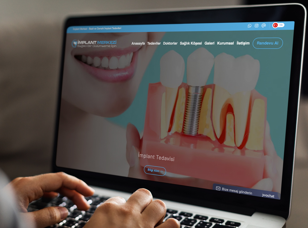 Implant Merkezi
